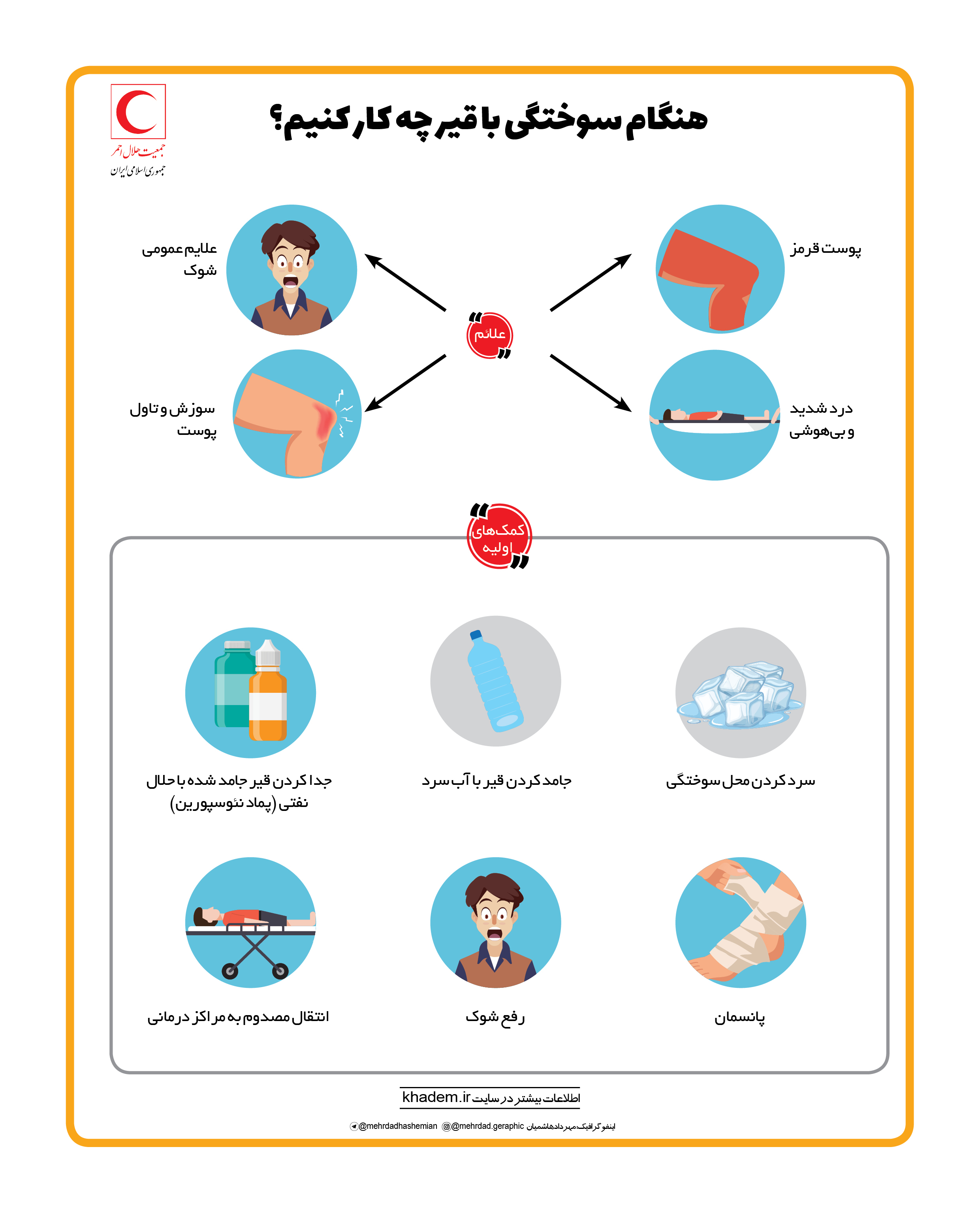 هنگام سوختگی با قیر چه‌کار کنیم؟/ اینفوگرافیک